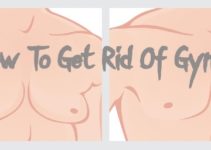 How To Get Rid Of Gyno